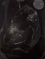 Mängden socker i Escalope de veau