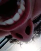 Mängden socker i Myrtilles