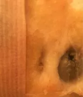 Mängden socker i Focaccia tradizionale con olive